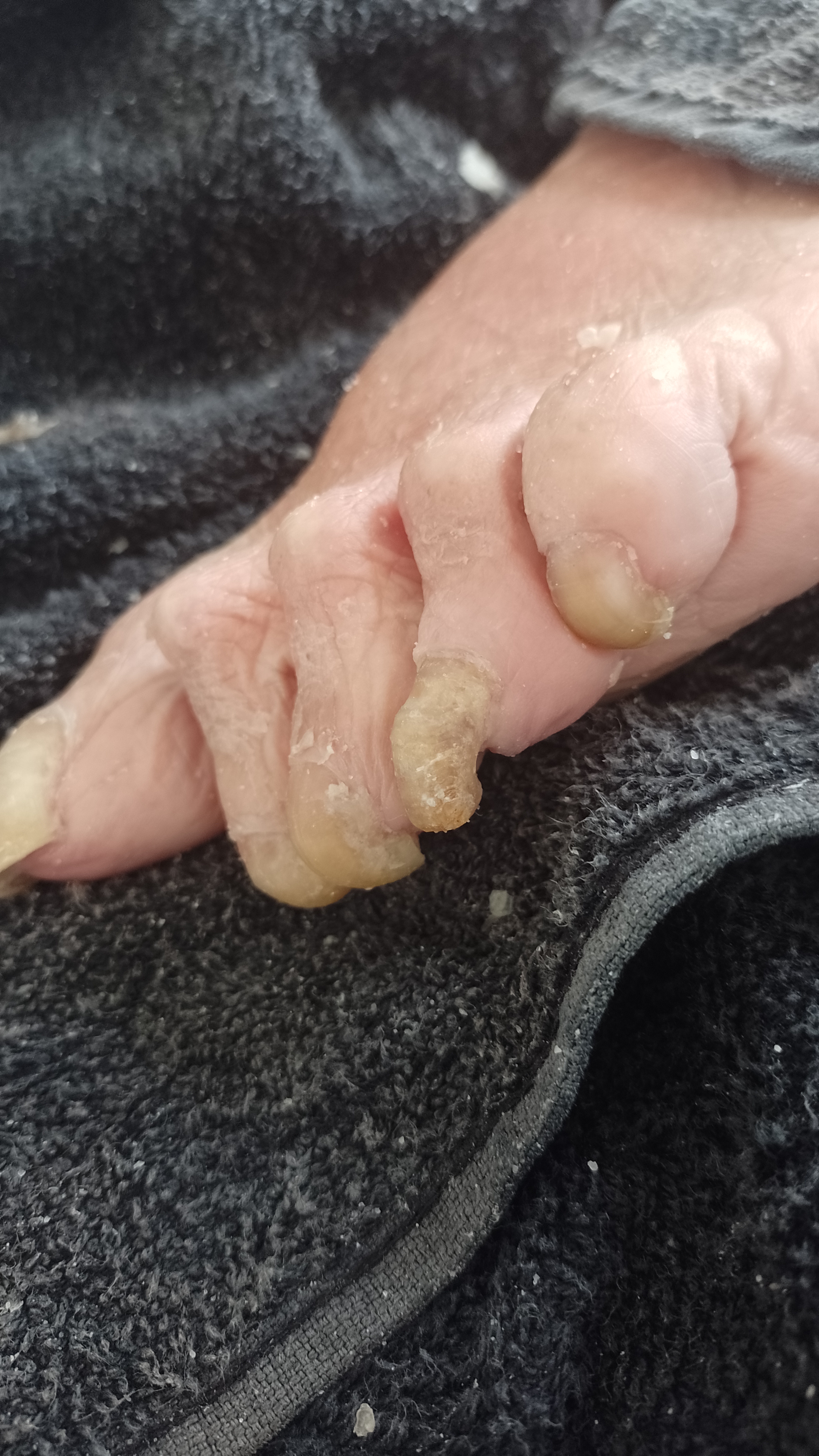 Podologia pés descalços em Itaguaí | Agilpass