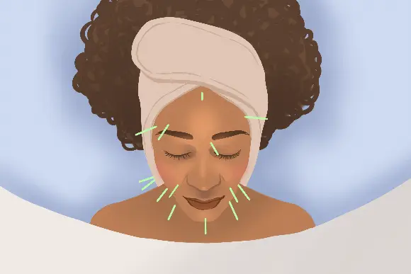 Acupuntura - Agilpass