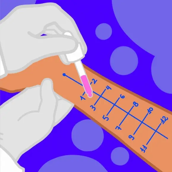 Alergista - Agilpass